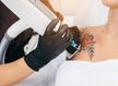 Remoção de tatuagem até 10cm