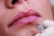 Revitalização Labial