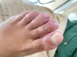 Pedicure com tratamento + gelinho